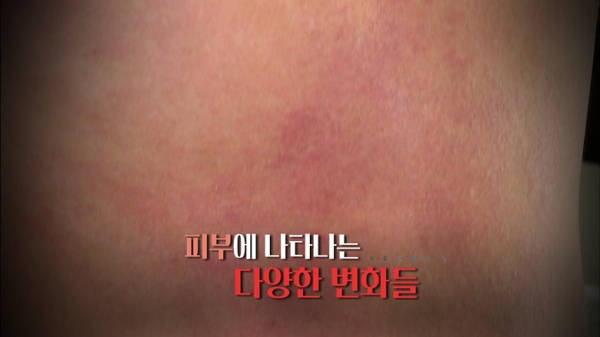[사진= KBS 1TV '생로병사의 비밀' 제공]